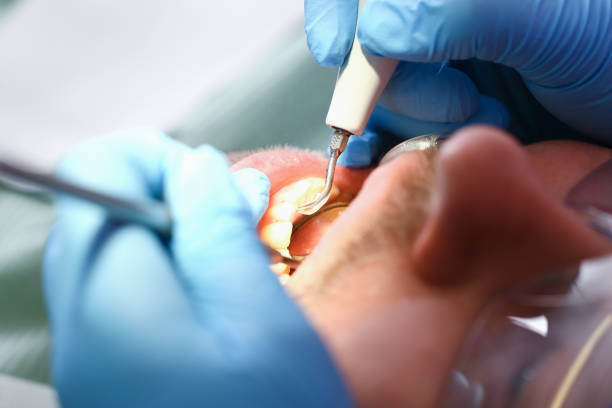 Best Emergency Root Canal Treatment in Manville, NJ