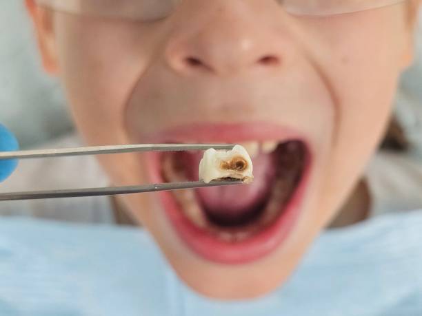 Best Pediatric Emergency Dentist in Manville, NJ