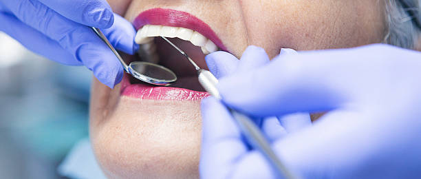 Best Emergency Treatment for Dental Infections or Abscesses in Manville, NJ